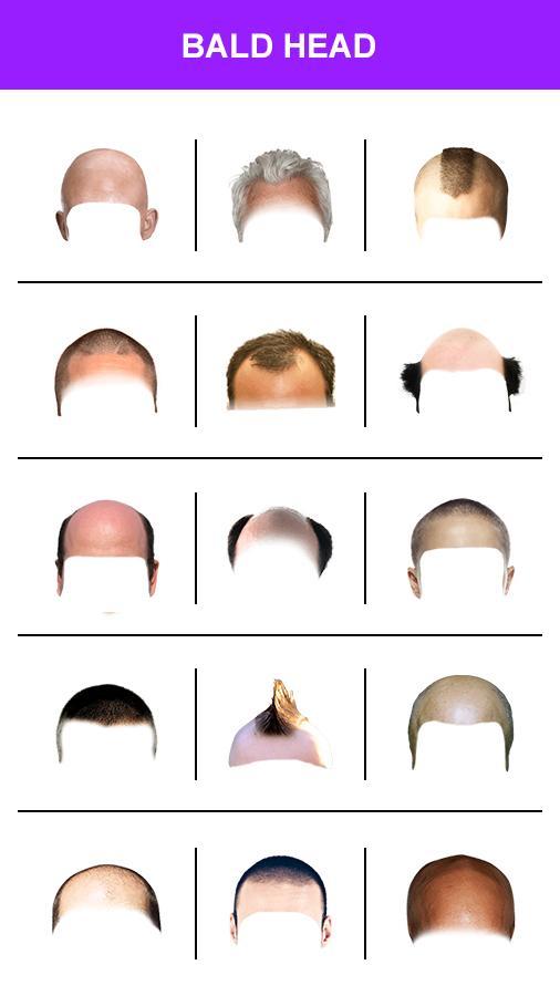 Make Me Bald Photo Editor 2022 screenshot image 5_funmod.online