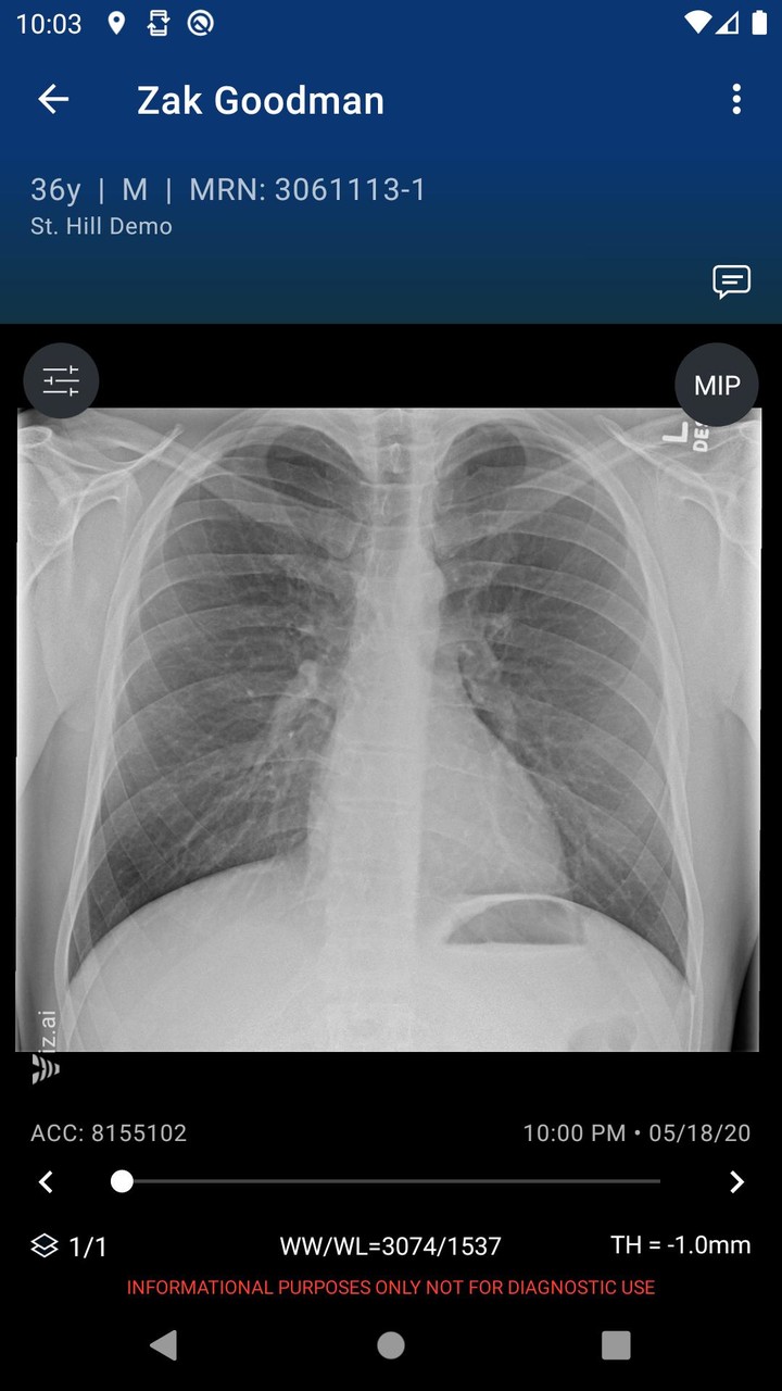 Viz.ai screenshot image 5_funmod.online