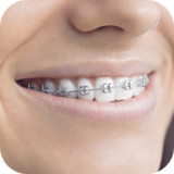 Teeth Braces Photo Maker- Braces Camera Editor1.5_funmod.online
